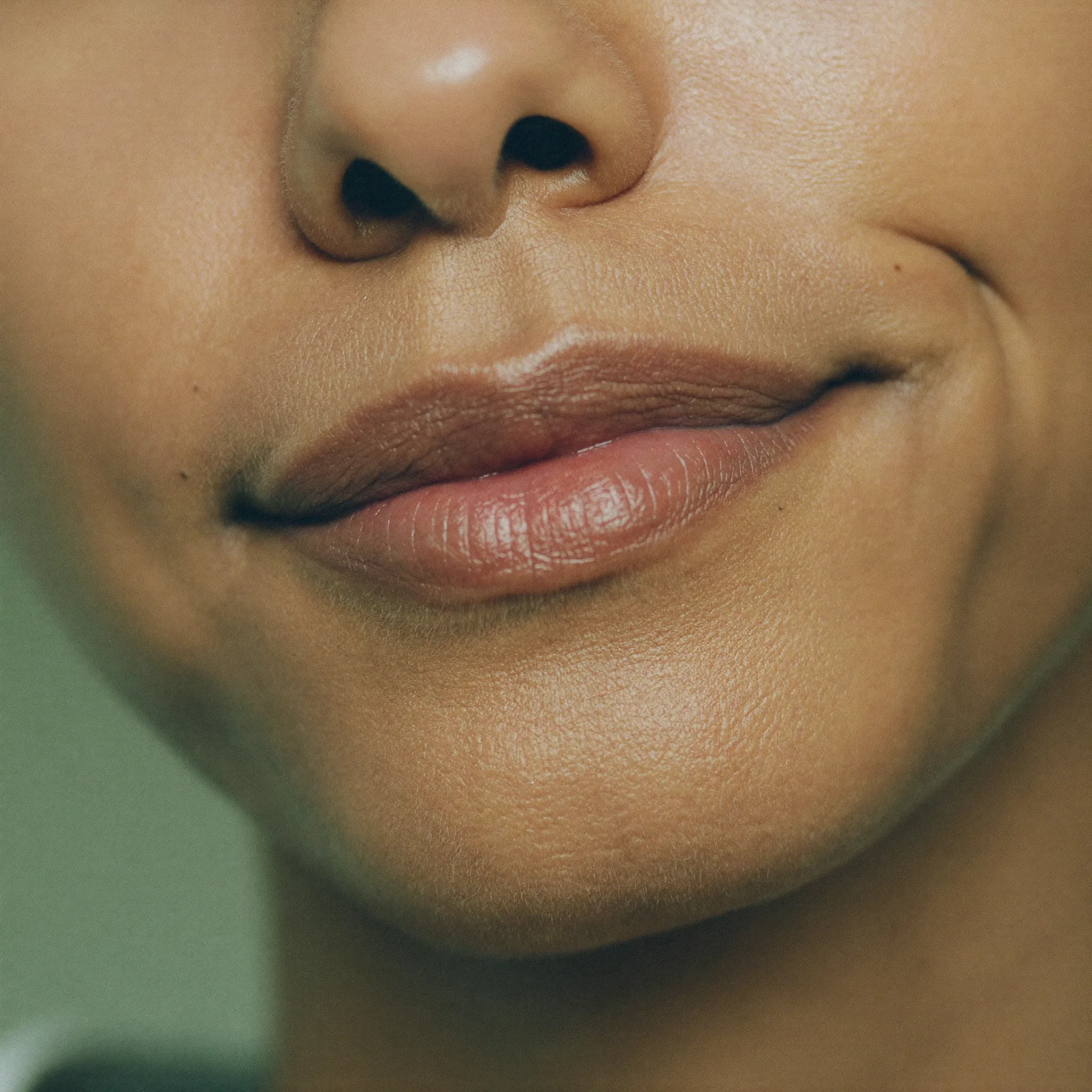Labios con realce natural de ácido hialurónico